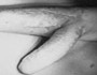 Penis wächst aus dem Arm